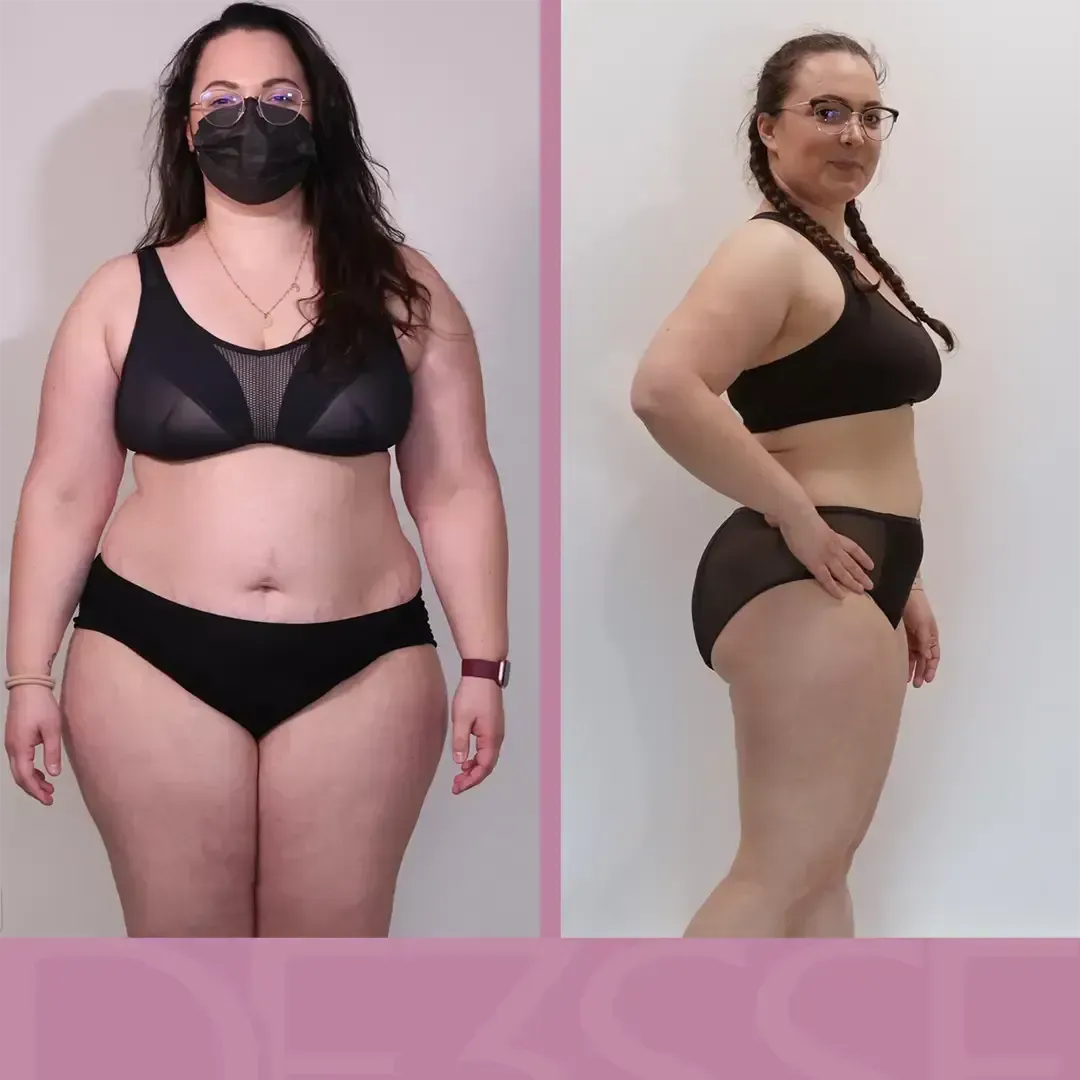 Transformation de Barbara