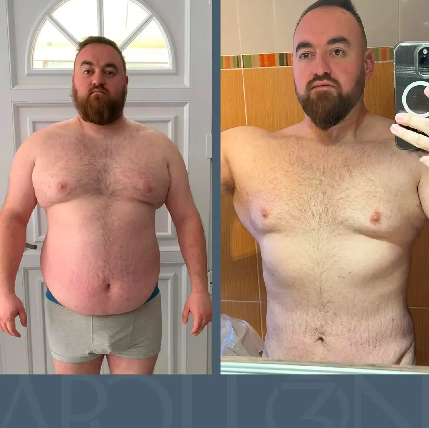 Transformation d'Arnaud