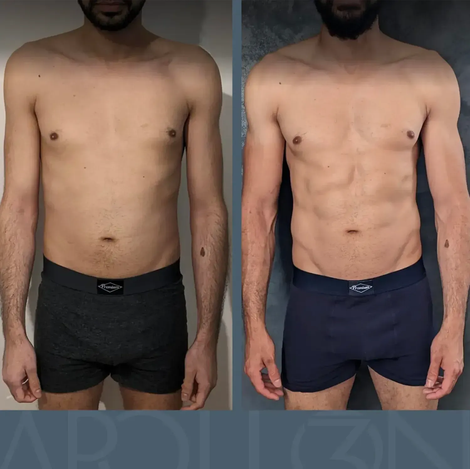 Transformation d'Ahmed