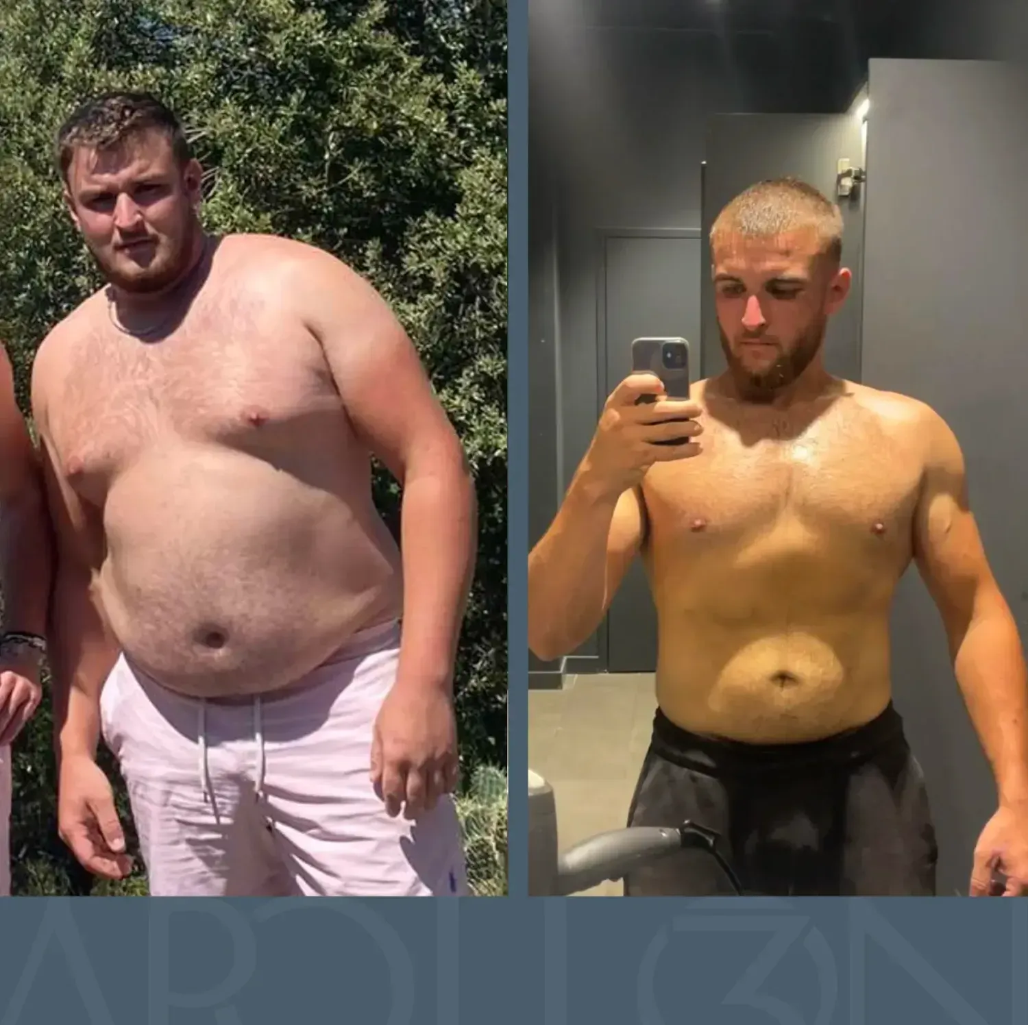 Transformation d’Anthony