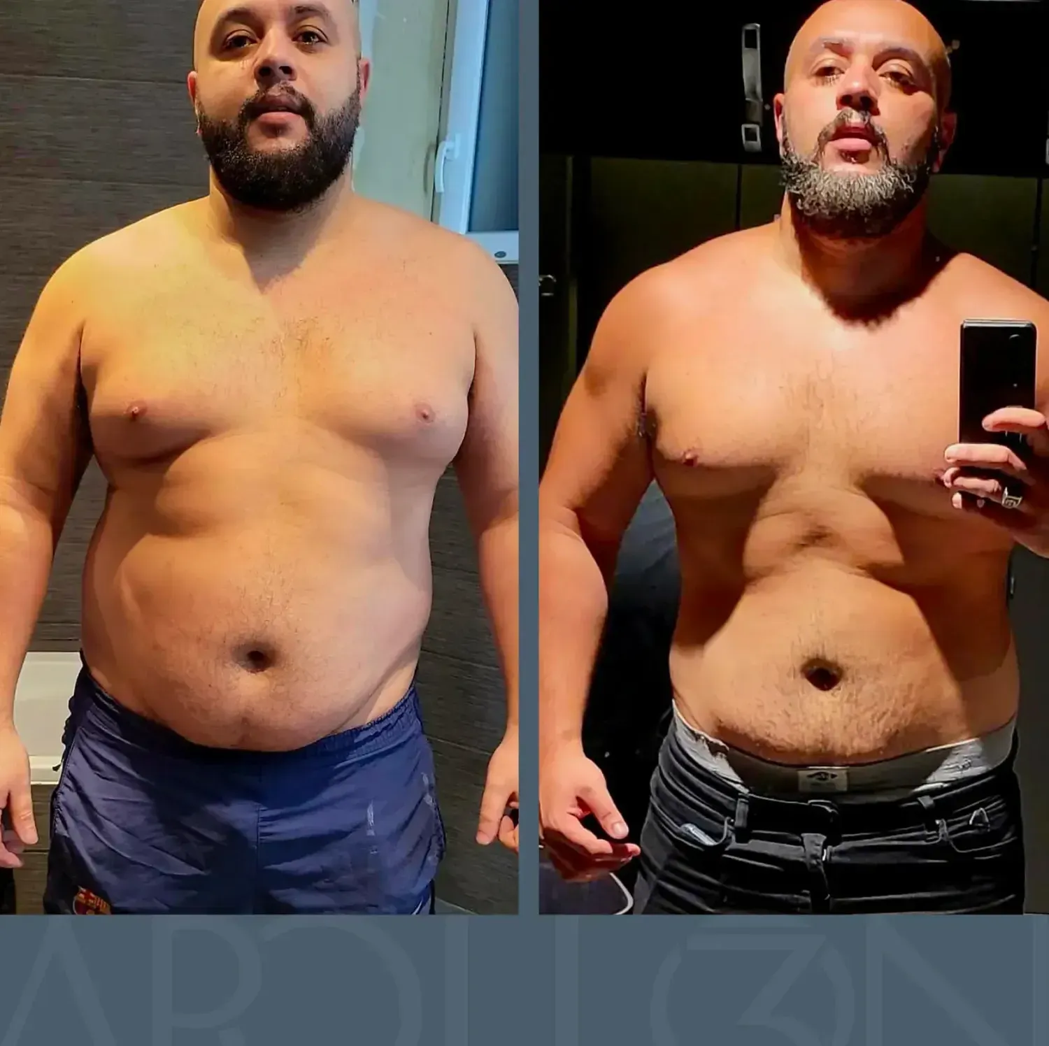 Transformation de Philippe