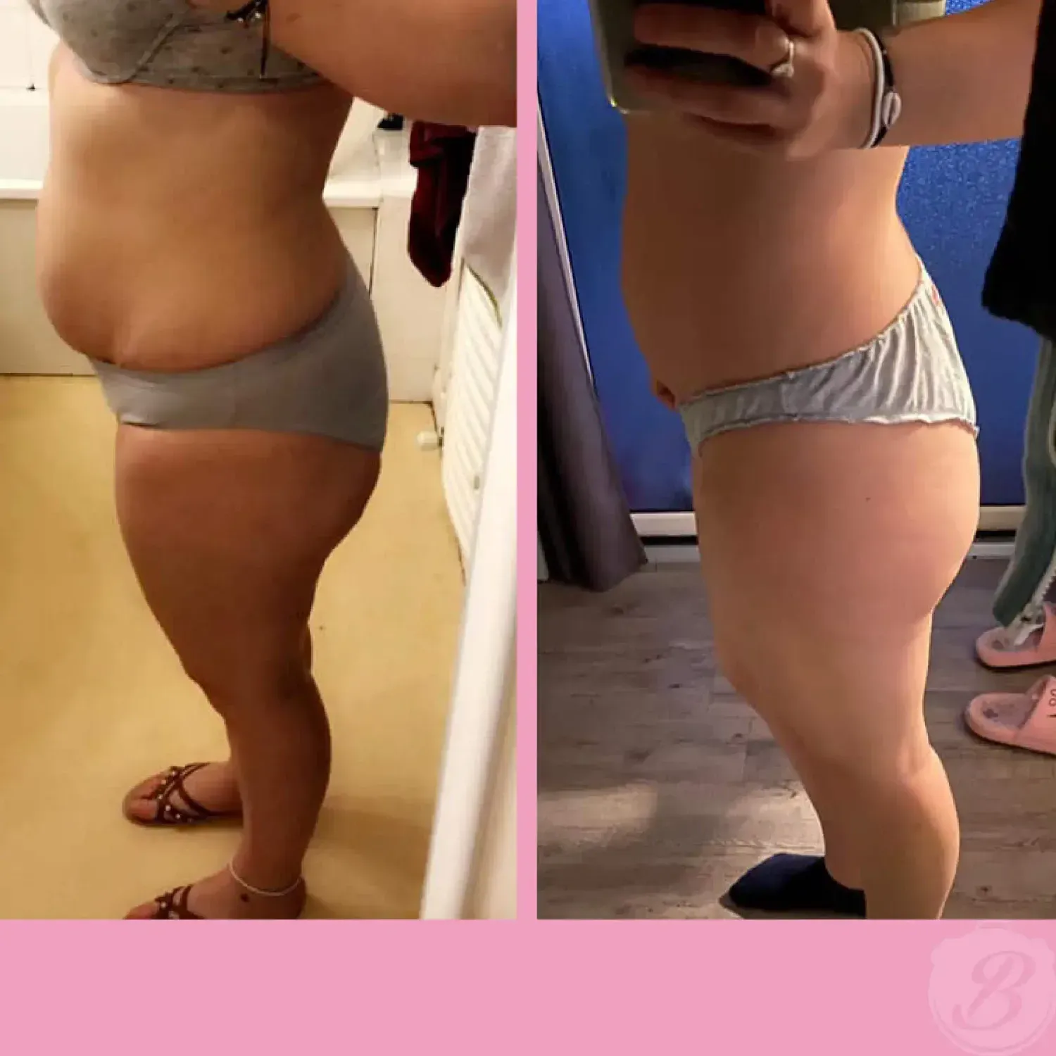 Transformation de Anais