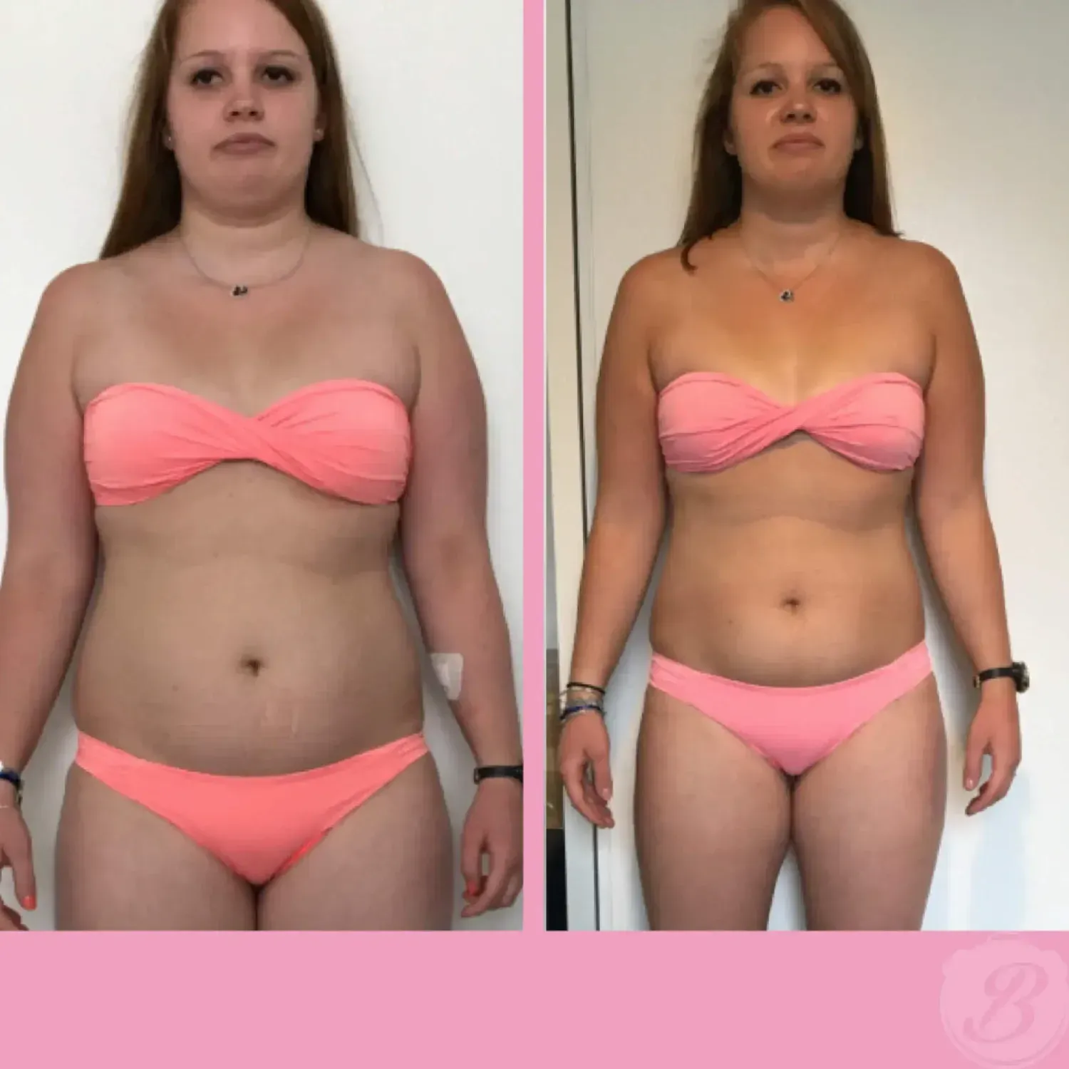 Transformation de Nelson