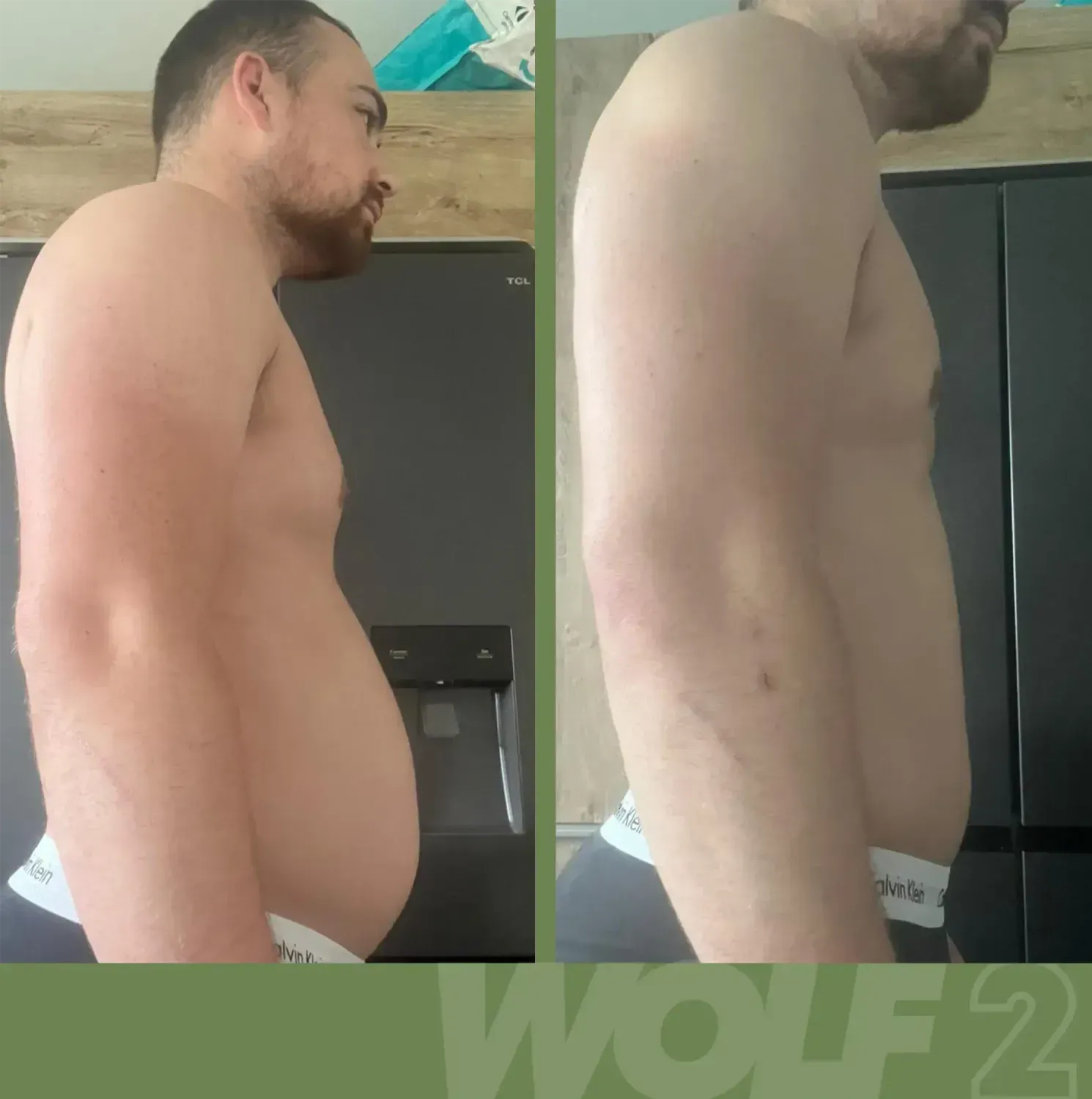 Transformation d'Anthony