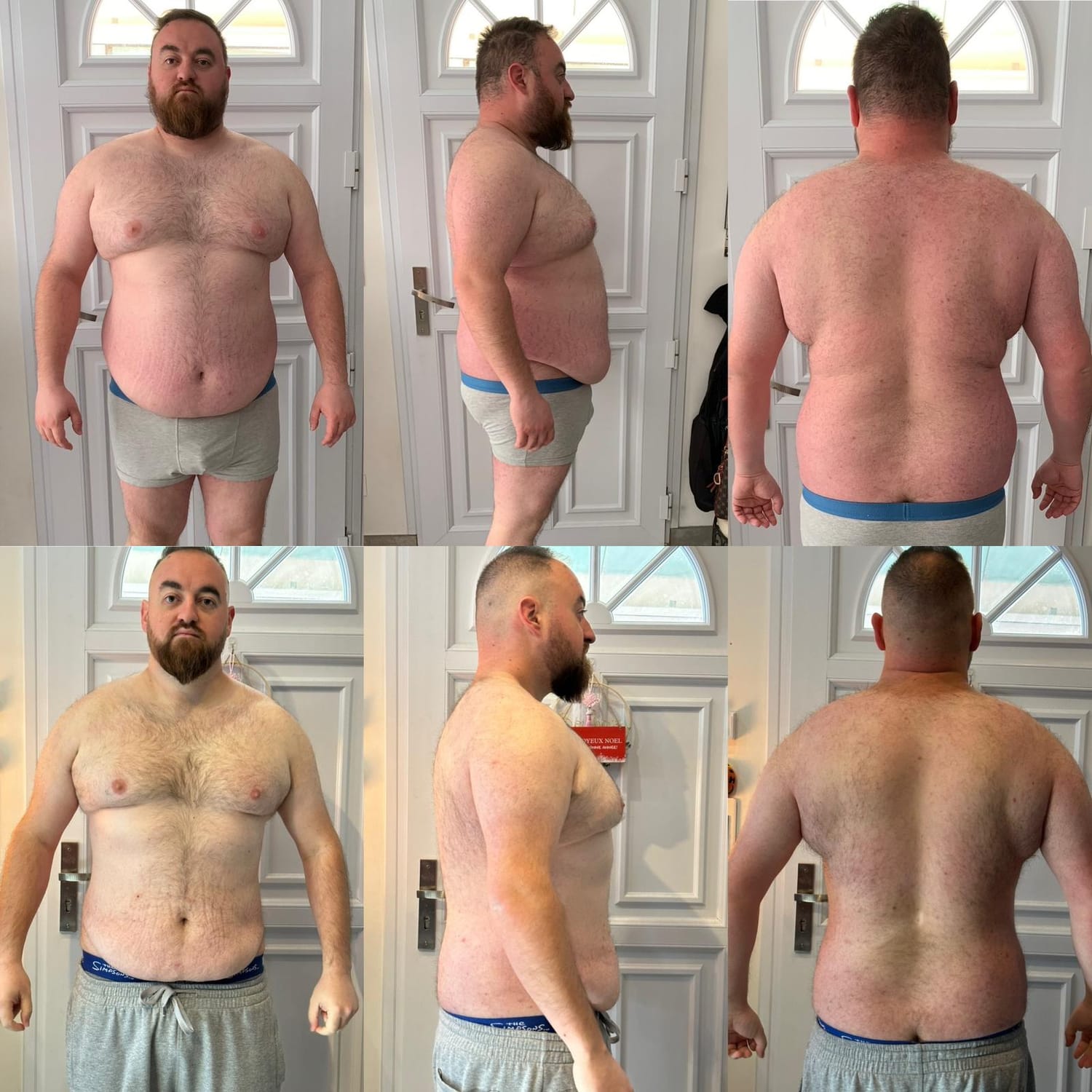 Transformation homme