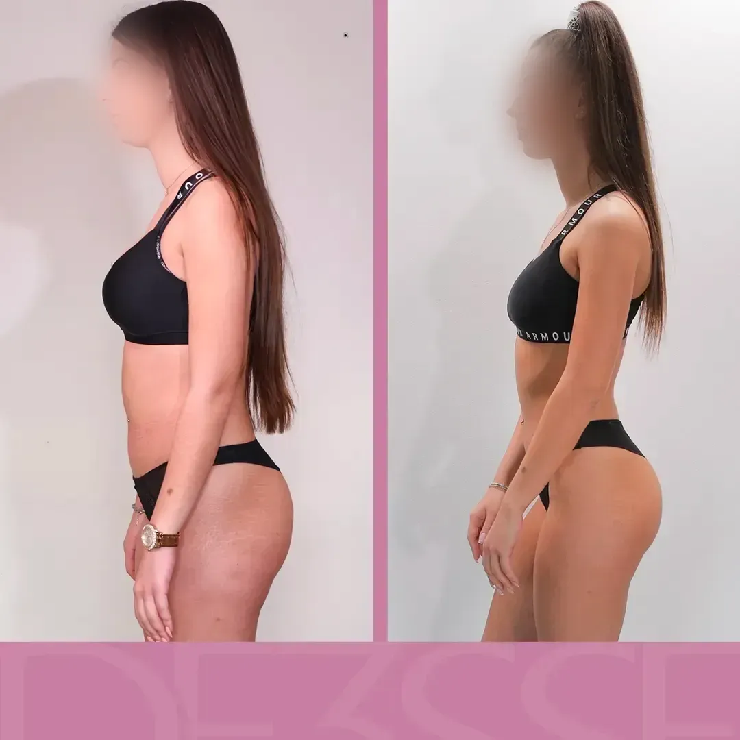 Transformation de Sandra