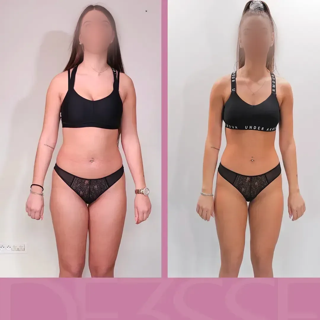 Transformation de Philippe