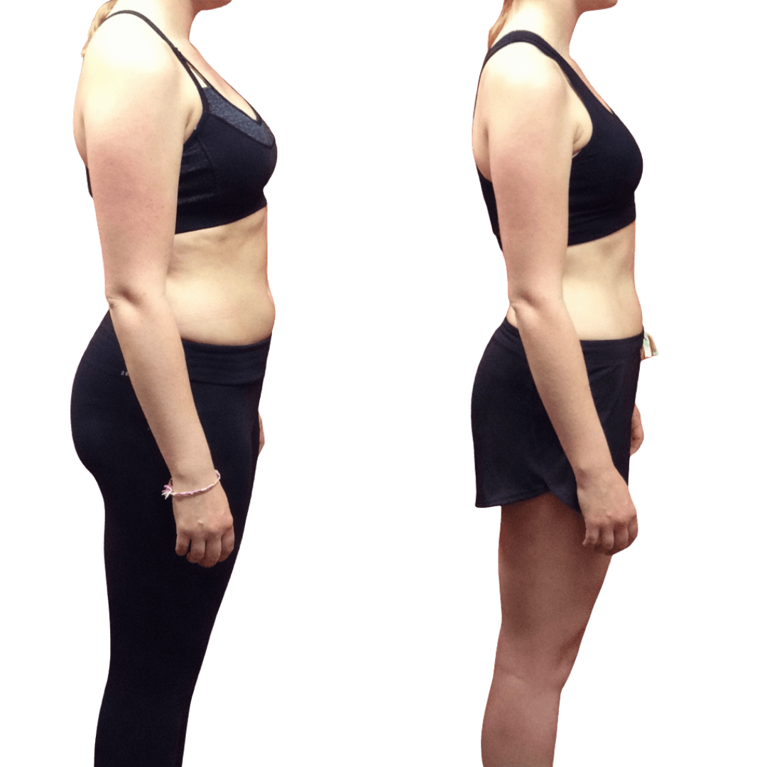 Emma transformation