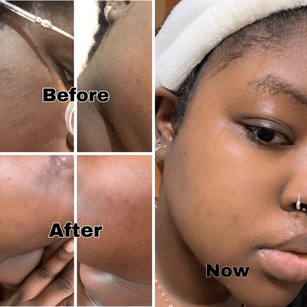 skin brightening results before and after