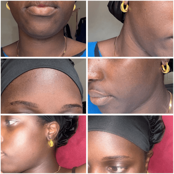 glowing skin transformation turmeric soap