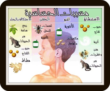 مسببات الحساسية فى الانسان