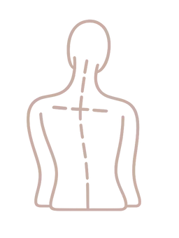 Illustration of a person with scoliosis with uneven shoulders