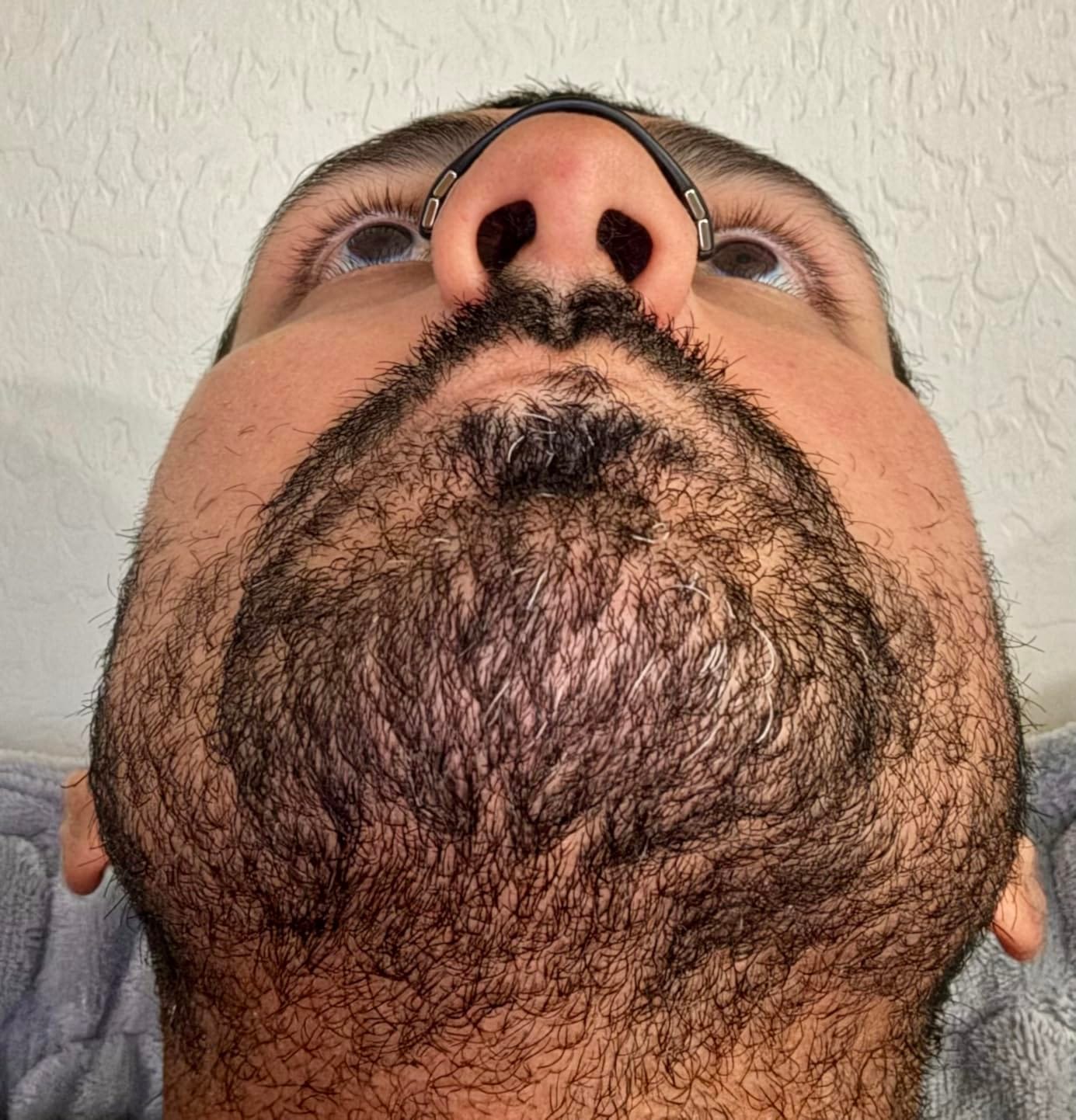 After using magnetic nasal strips