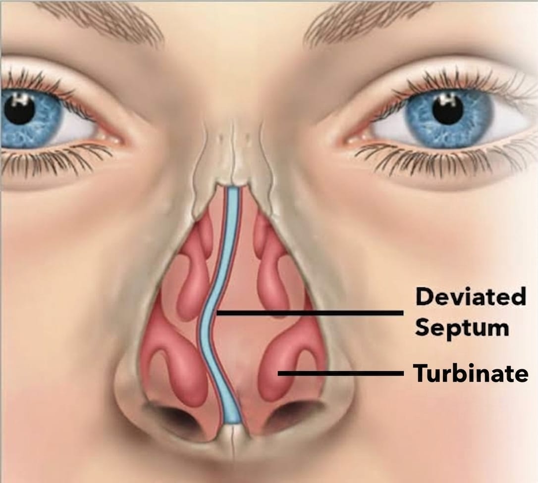 Cross-section diagram of the nasal airway