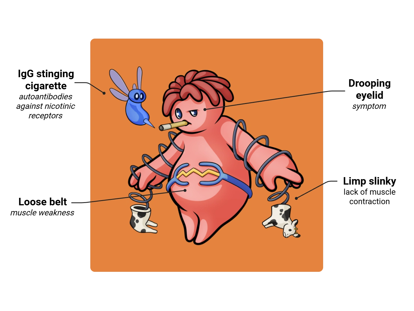 Myasthenia Gravis Medimon infographic with labeled medical features and mnemonic annotations.