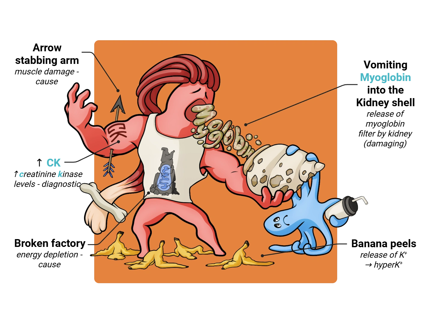 Rhabdomyolysis Medimon infographic with labeled medical features and mnemonic annotations.