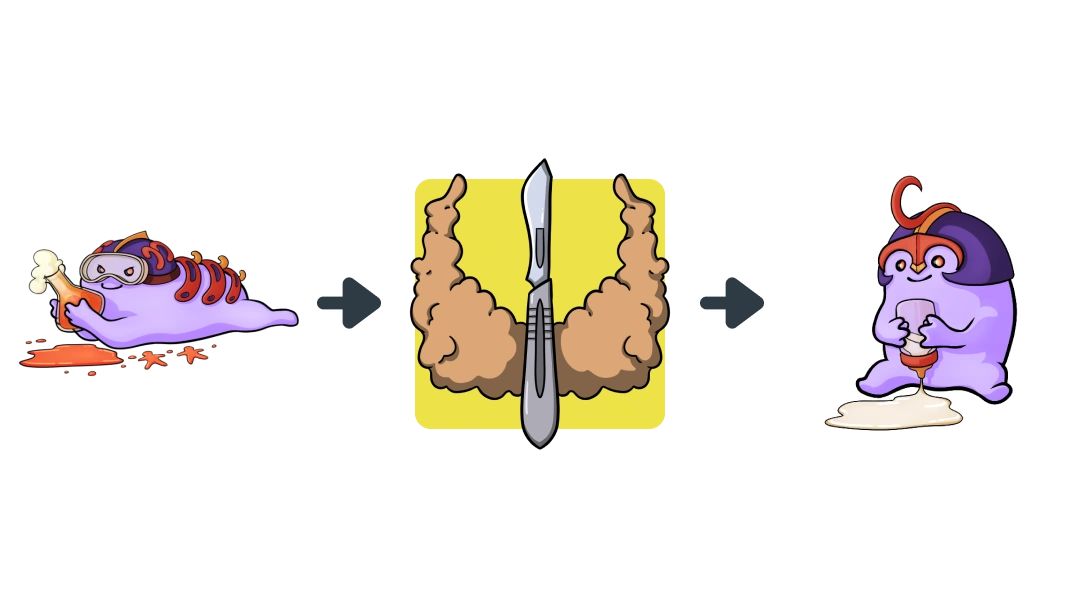 Treatment diagram of Surgical Thyroid Removal converting C-Cell Hyperplasia into Parafollicular C-Cell.