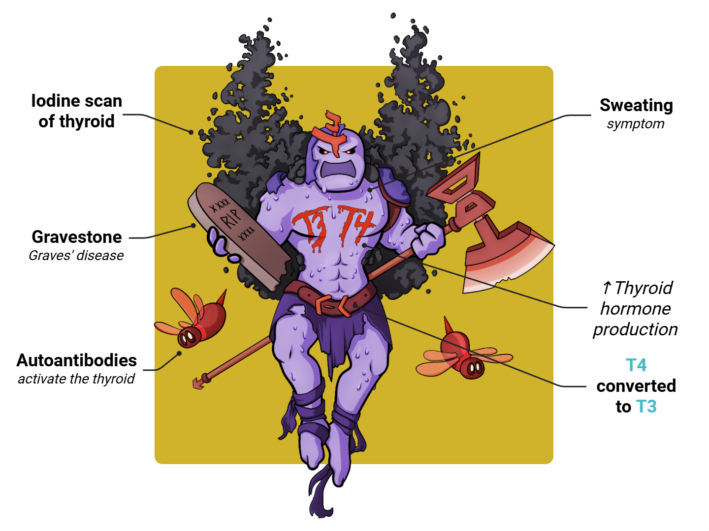 Graves' Disease Medimon infographic with labeled medical features and mnemonic annotations.