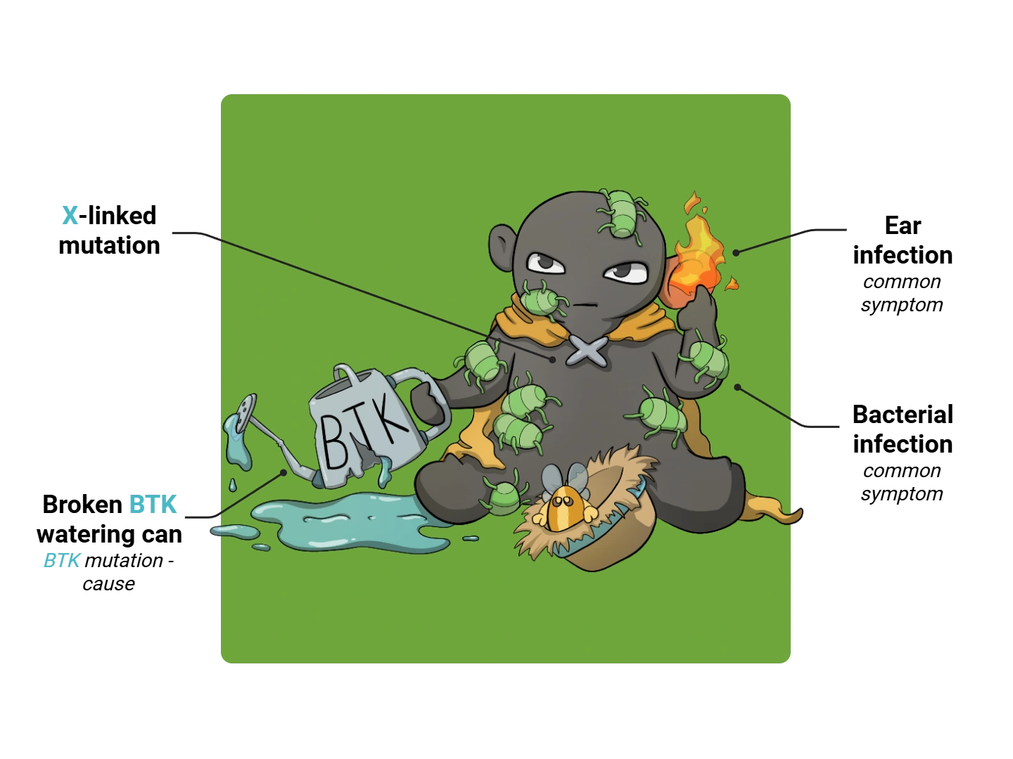 Bruton Disease Medimon infographic with labeled medical features and mnemonic annotations.