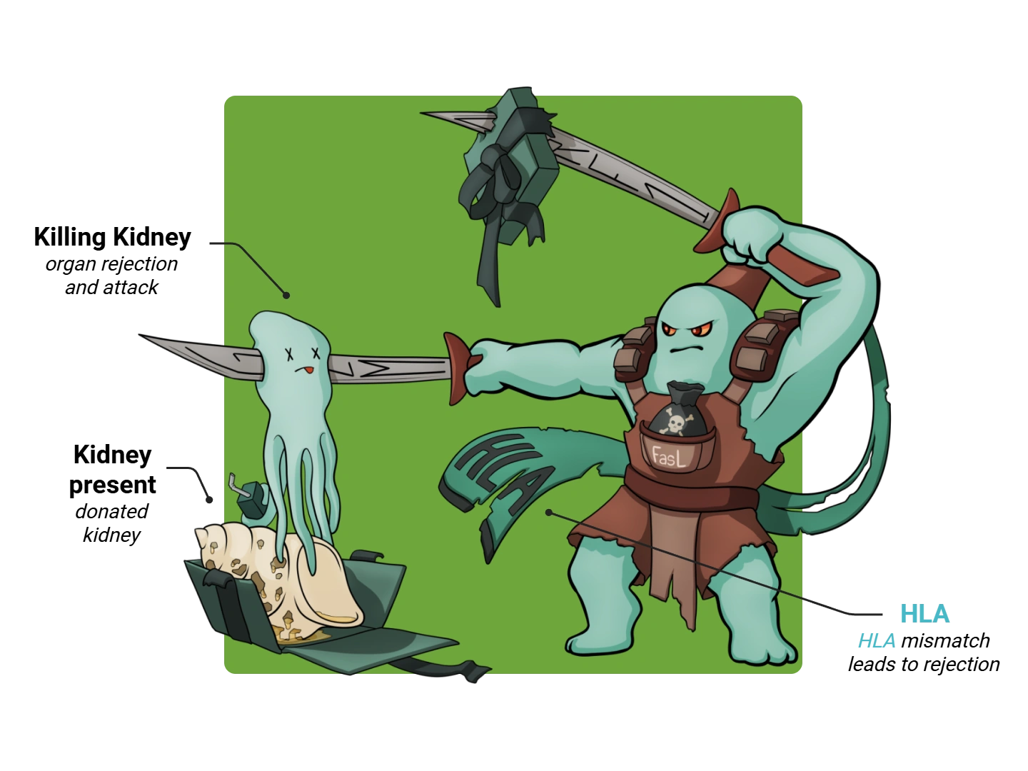 Acute Rejection Medimon infographic with labeled medical features and mnemonic annotations.