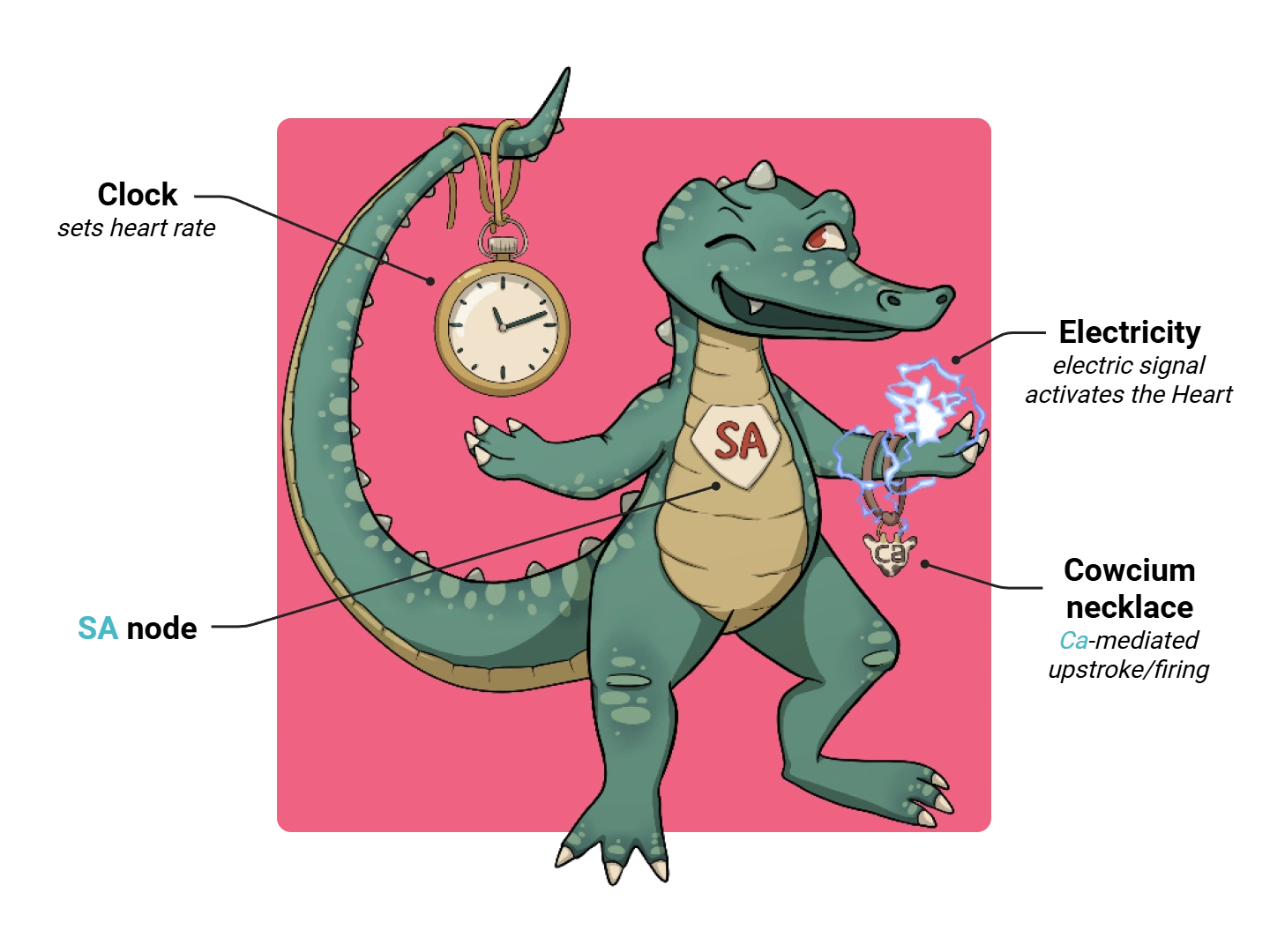 SA Node Medimon infographic with labeled medical features and mnemonic annotations.