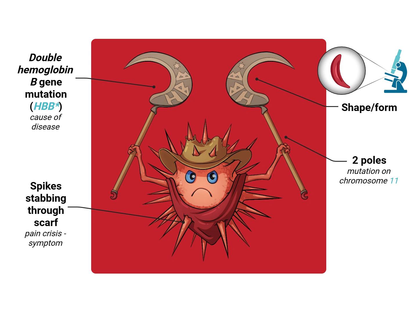 Sickle Cell Disease Medimon infographic with labeled medical features and mnemonic annotations.