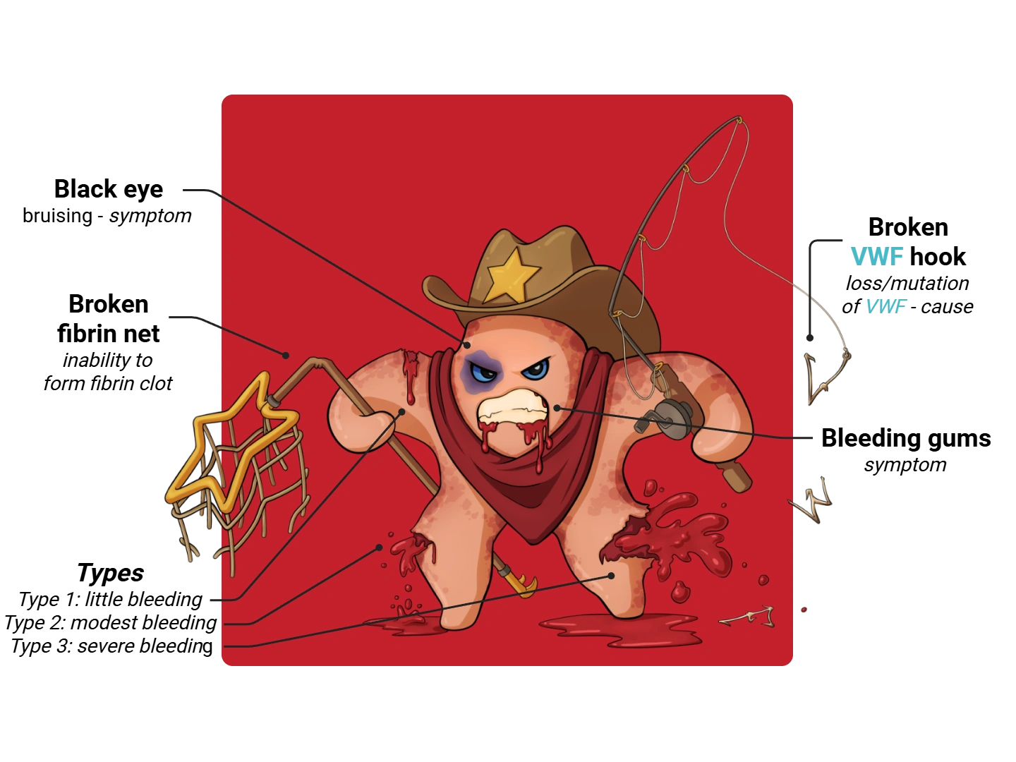 Von Willebrand Disease Medimon infographic with labeled medical features and mnemonic annotations.