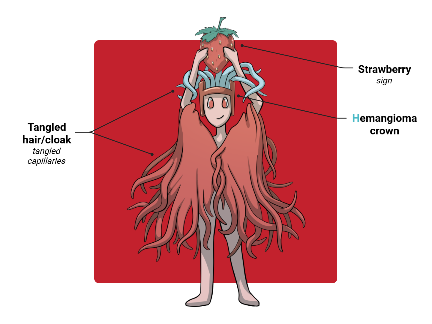 Hemangioma Medimon infographic with labeled medical features and mnemonic annotations.