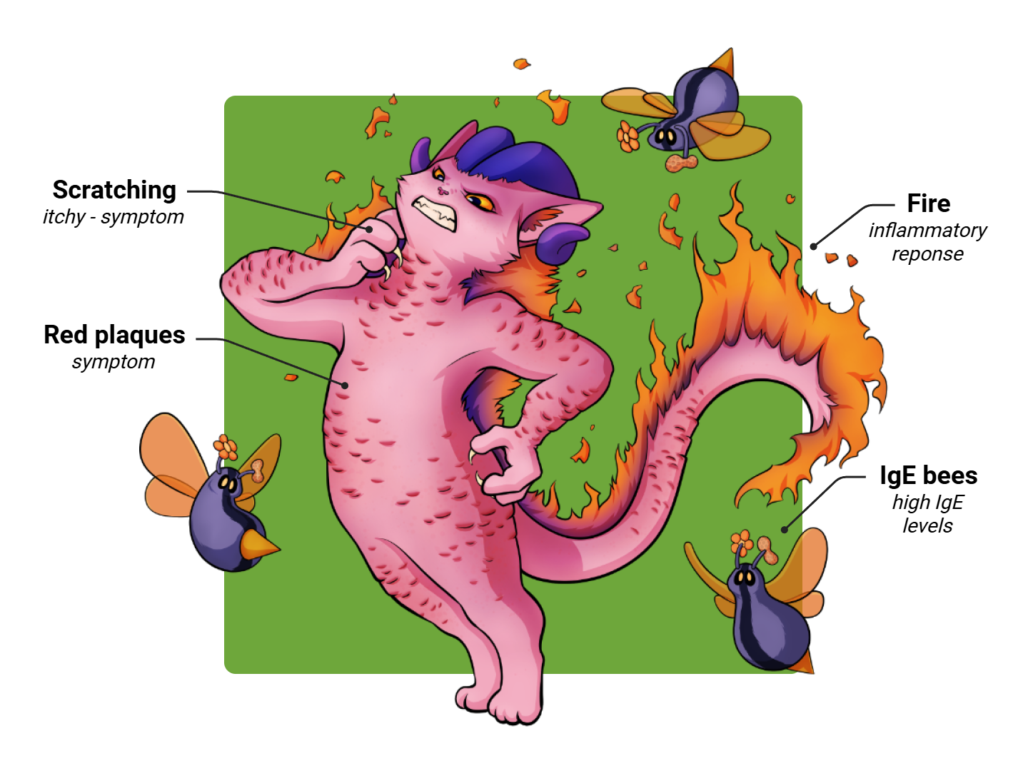 Addison Disease Medimon infographic with labeled medical features and mnemonic annotations.