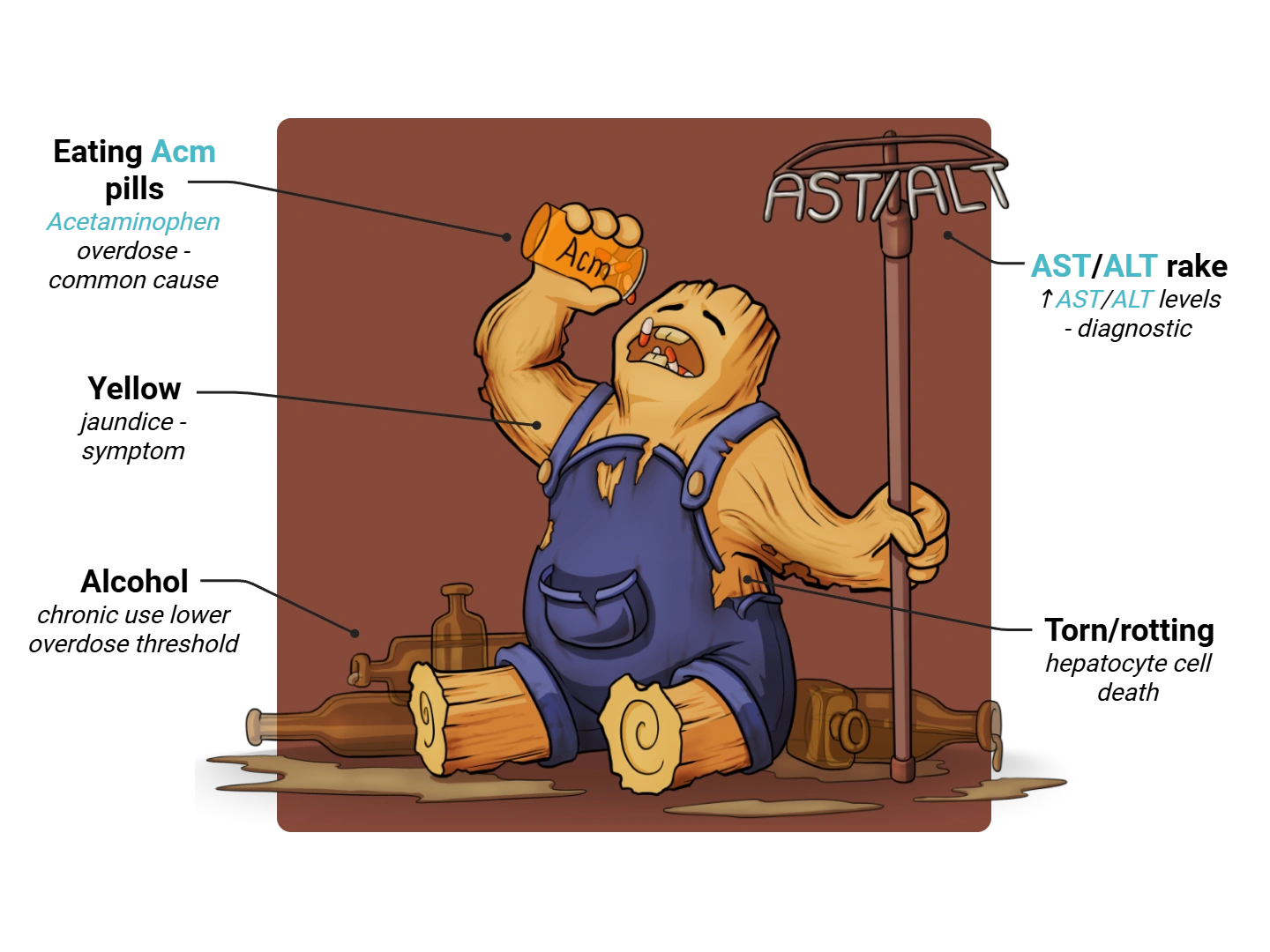 N-Acetyl Cysteine Medimon infographic with labeled medical features and mnemonic annotations.