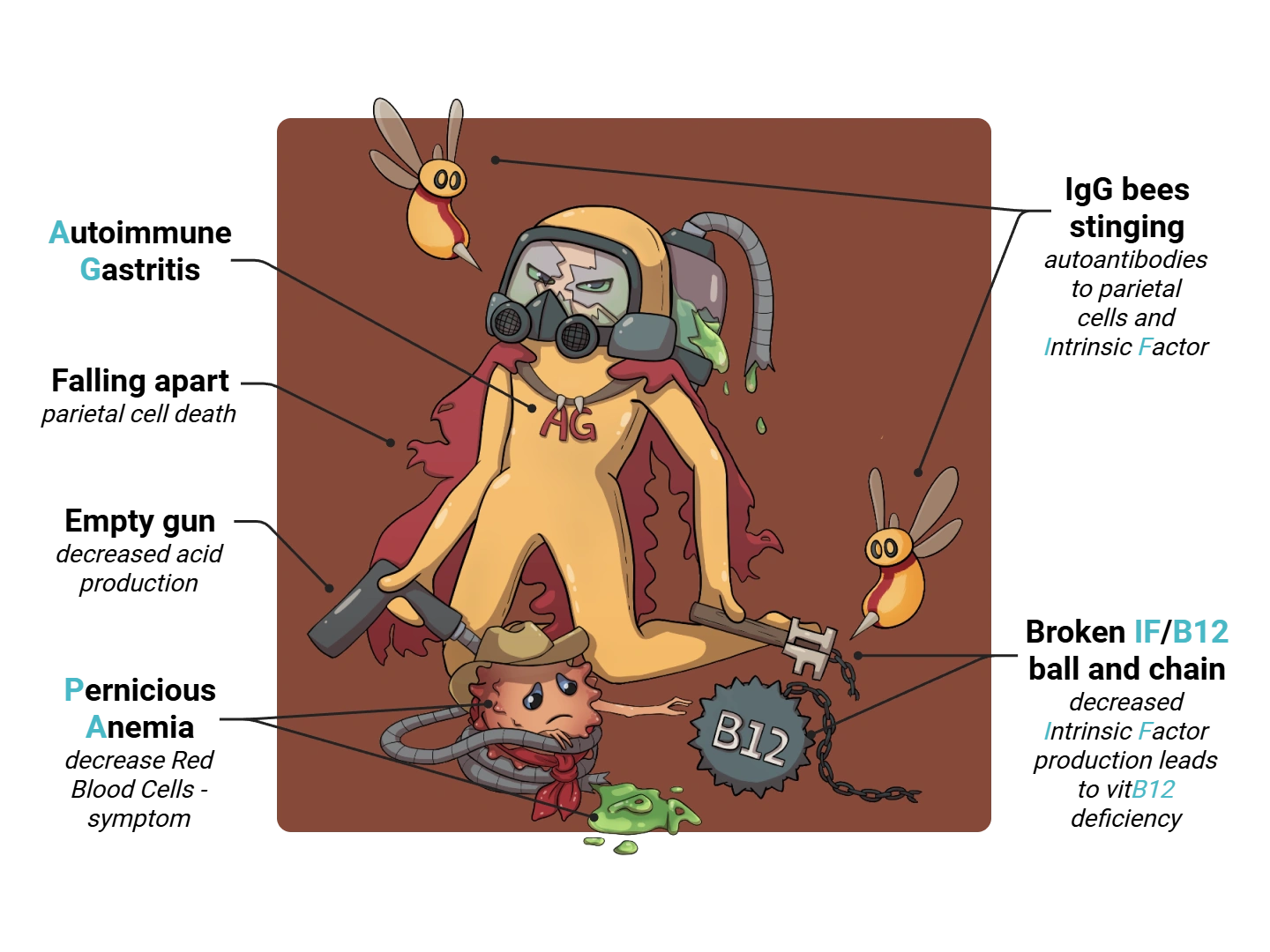 Autoimmune Gastritis Medimon infographic with labeled medical features and mnemonic annotations.