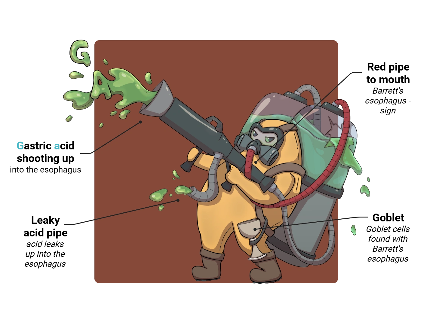 GERD Medimon infographic with labeled medical features and mnemonic annotations.