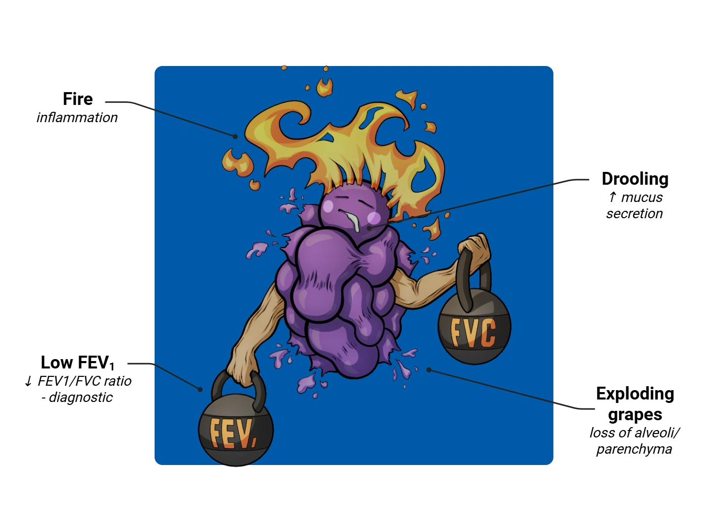COPD Medimon infographic with labeled medical features and mnemonic annotations.