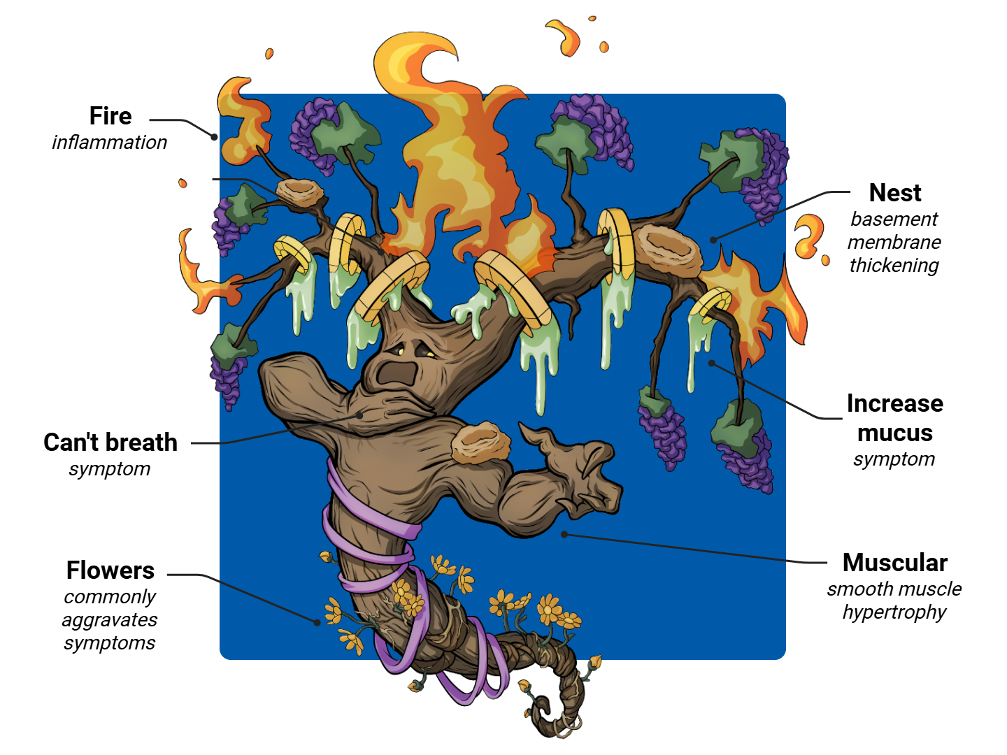 Asthma Medimon infographic with labeled medical features and mnemonic annotations.