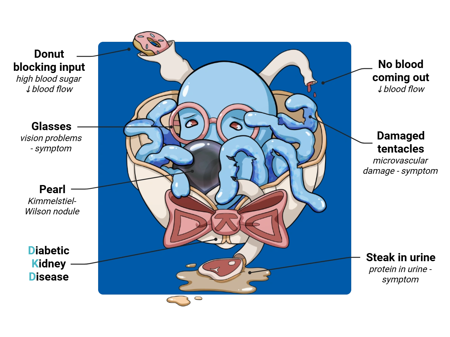 Diabetic Kidney Disease Medimon infographic with labeled medical features and mnemonic annotations.