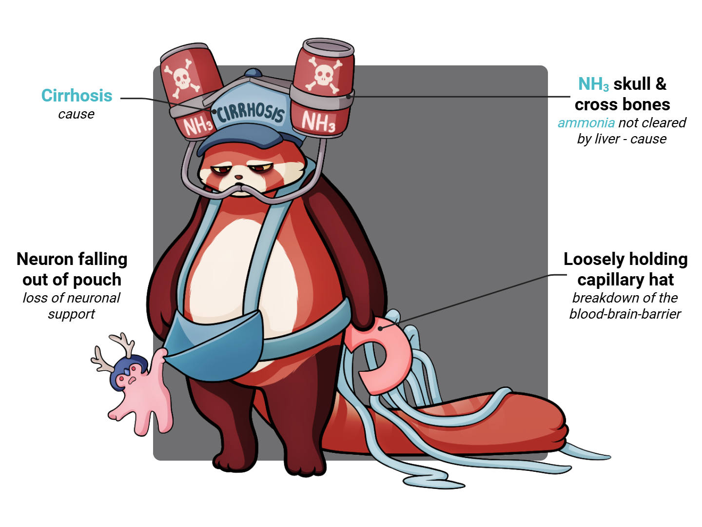Hepatic Encephalopathy Medimon infographic with labeled medical features and mnemonic annotations.
