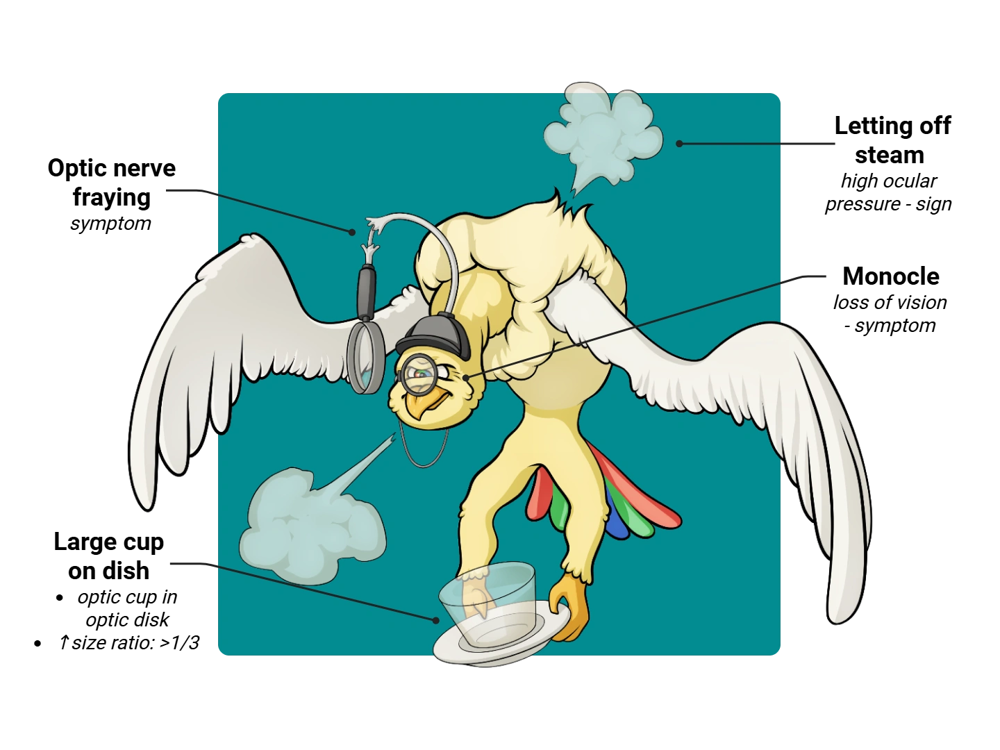 Glaucoma Medimon infographic with labeled medical features and mnemonic annotations.