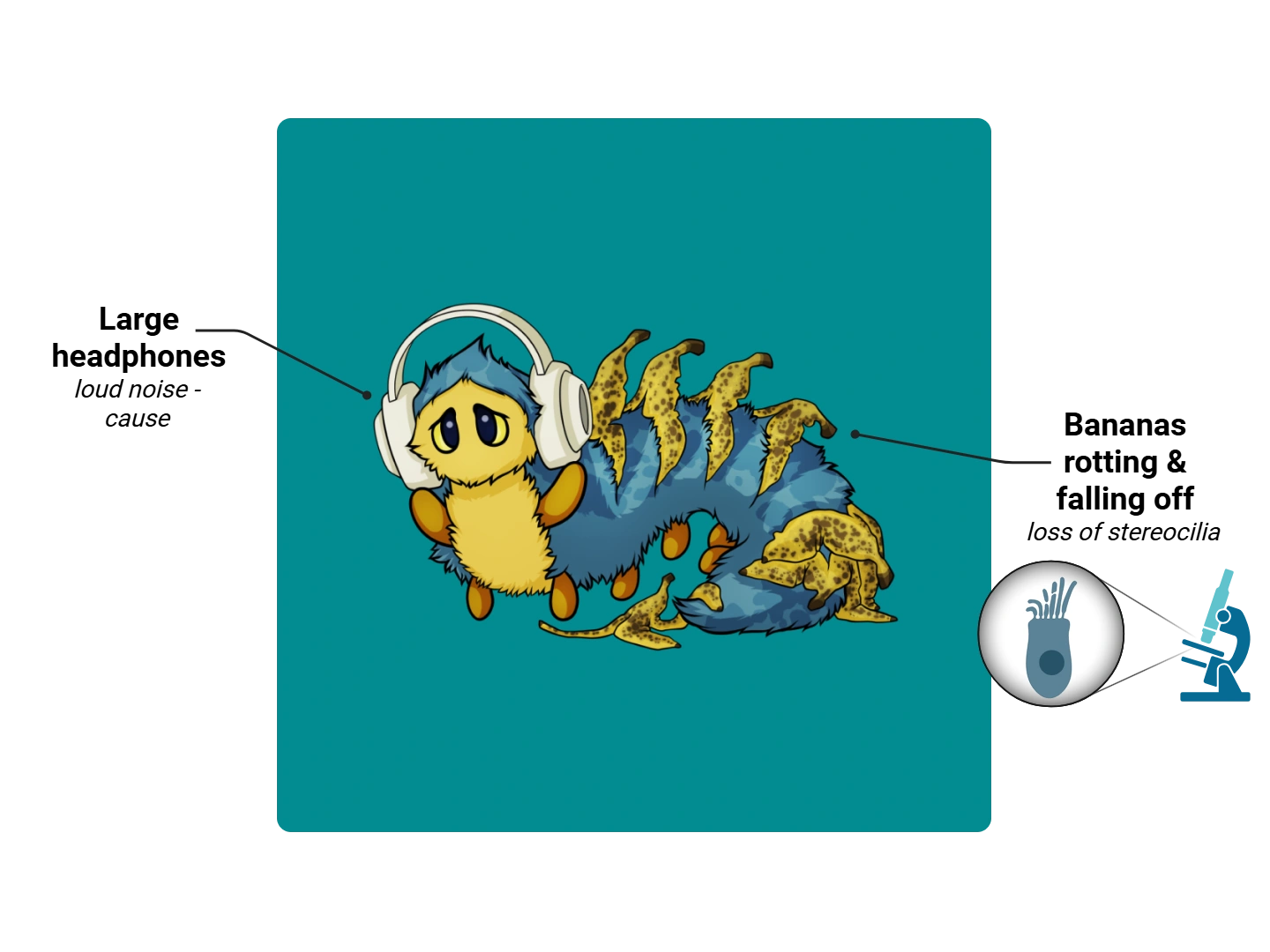 Noise-Induced Hearing Loss Medimon infographic with labeled medical features and mnemonic annotations.