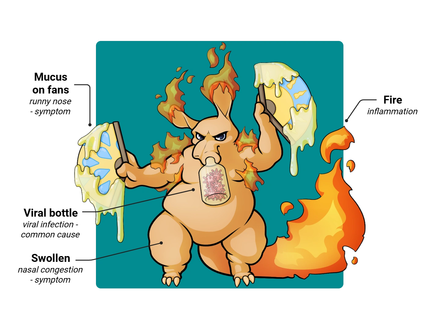 Sinusitis Medimon infographic with labeled medical features and mnemonic annotations.