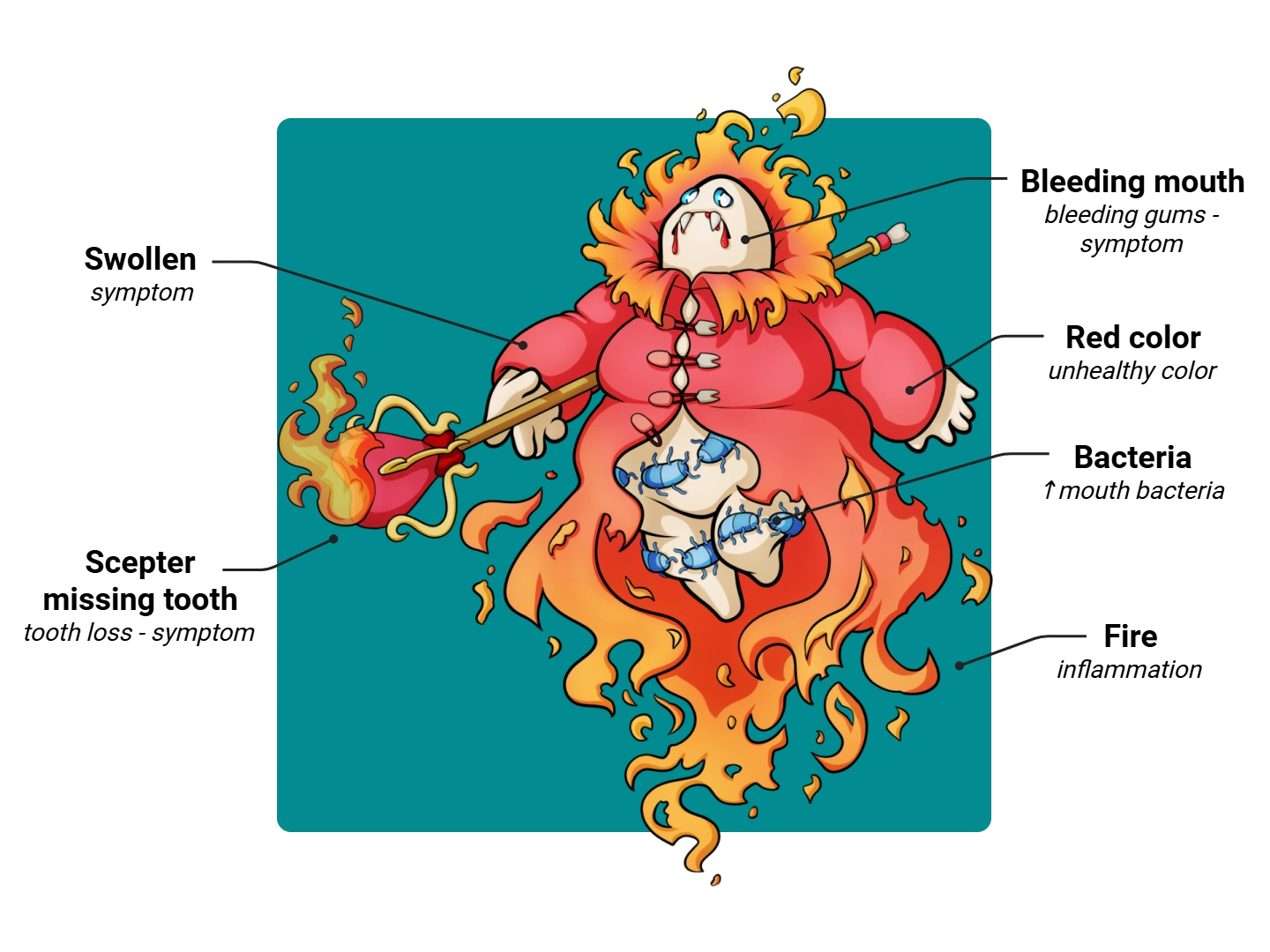 Periodontal Disease Medimon infographic with labeled medical features and mnemonic annotations.