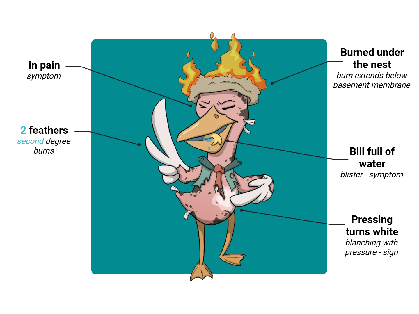 Second-Degree Burn Medimon infographic with labeled medical features and mnemonic annotations.