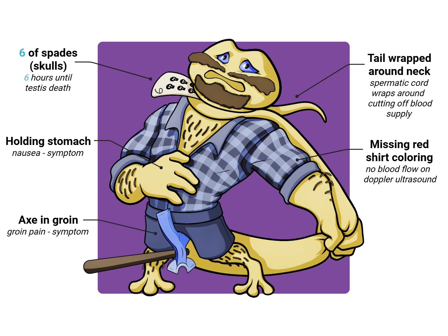 Testicular Torsion Medimon infographic with labeled medical features and mnemonic annotations.