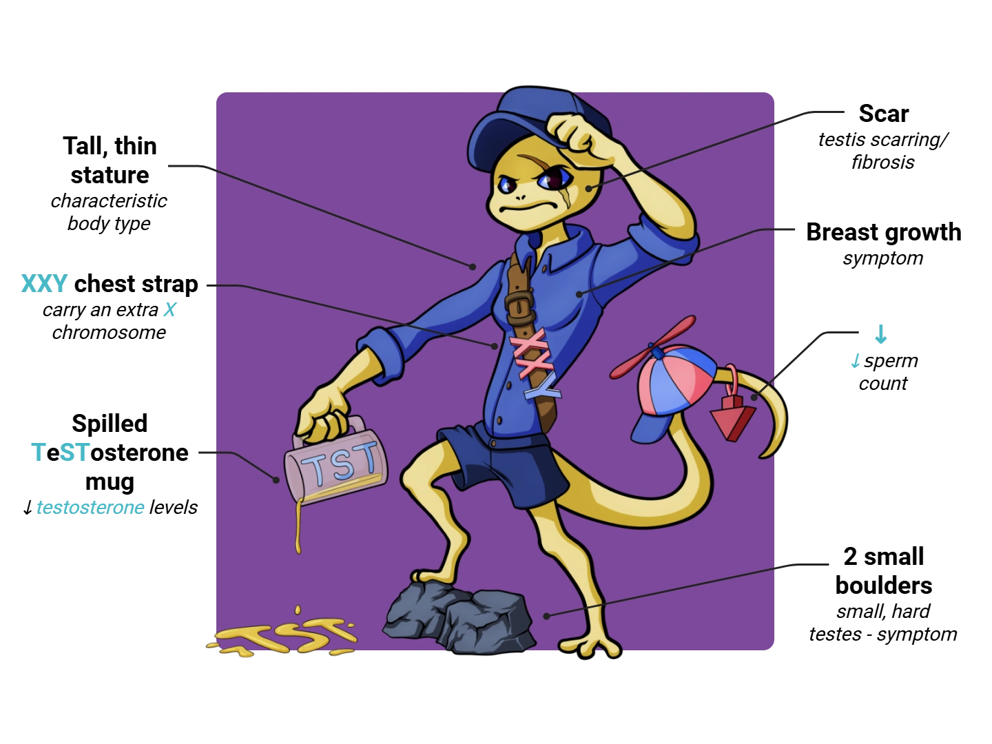 Klinefelter Syndrome Medimon infographic with labeled medical features and mnemonic annotations.