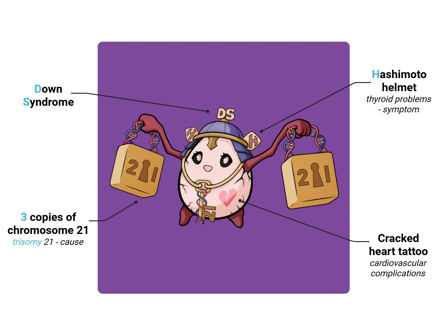 Down Syndrome Medimon infographic with labeled medical features and mnemonic annotations.