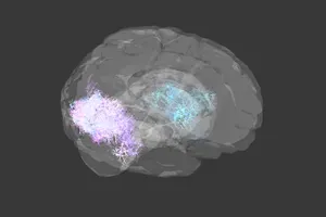 EEG signal processing visualisation