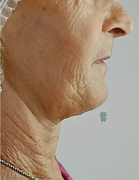 Avant