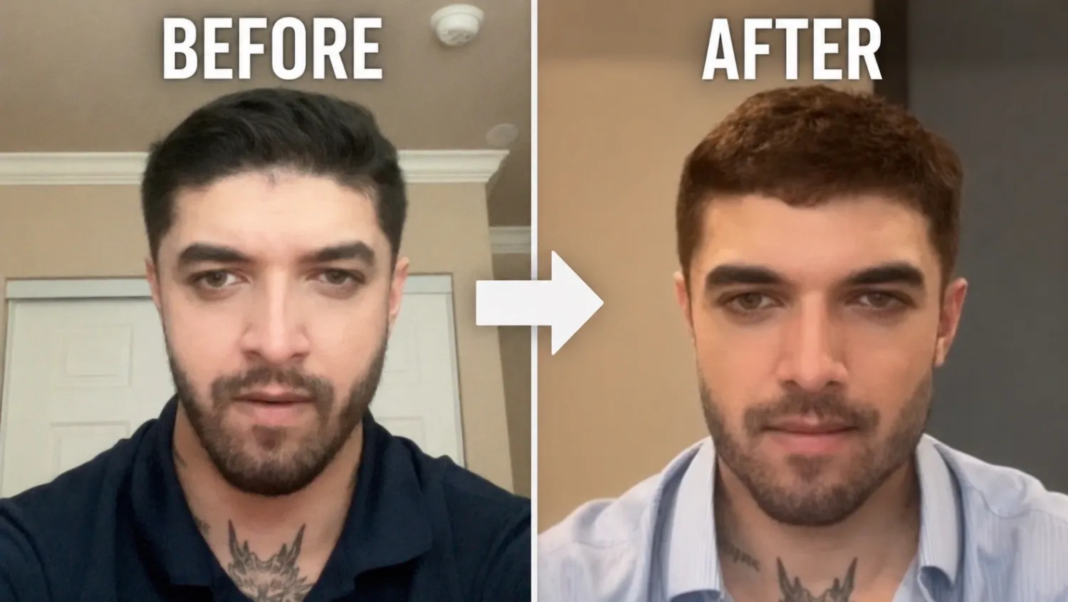 FaceMetrics Before and After