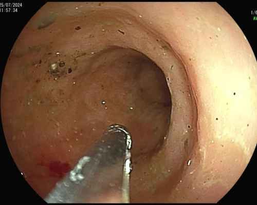 Endoscopia digestiva felina