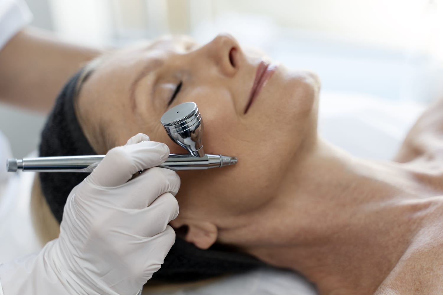 Micro-dermabrasion