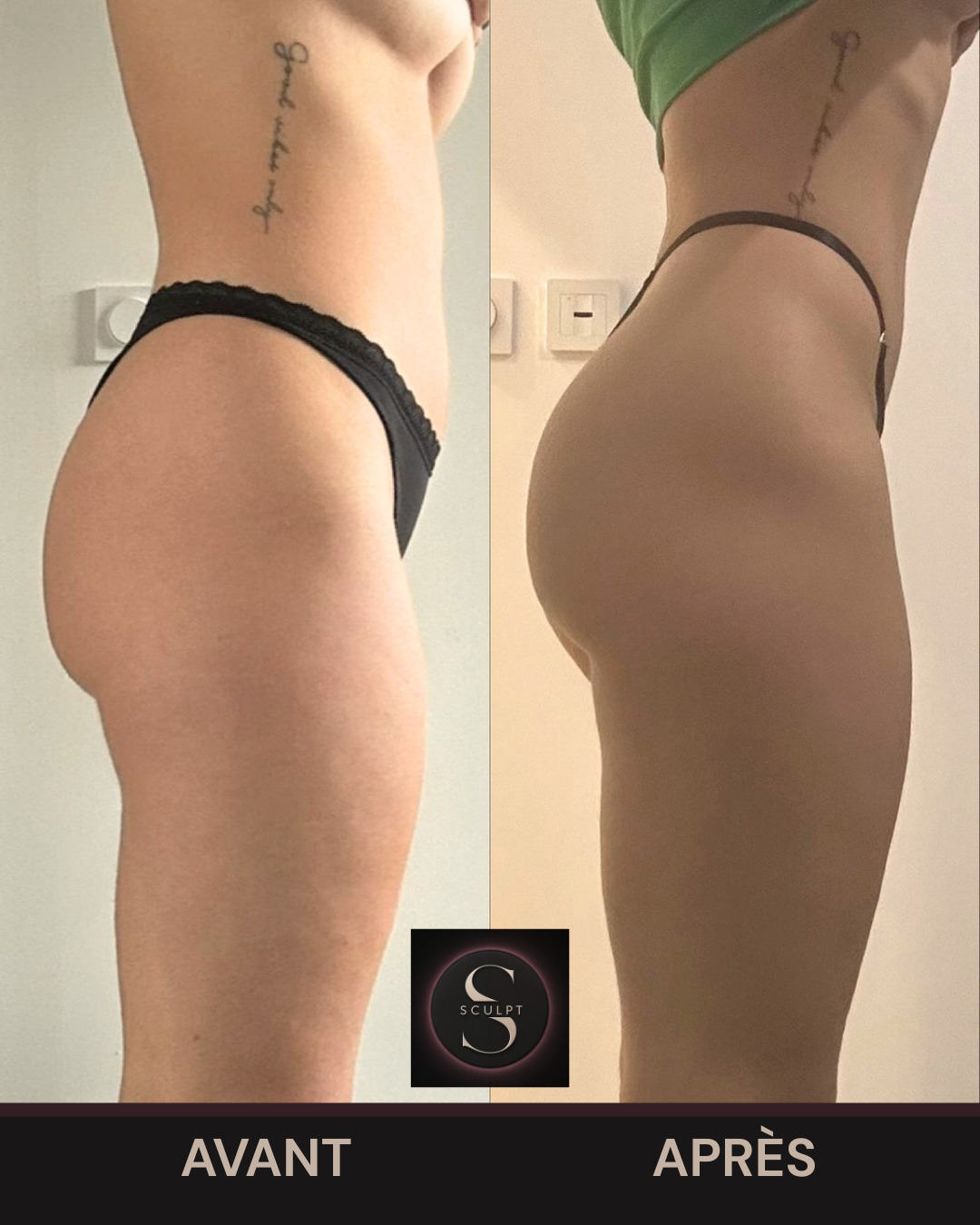 Transformation – Léa